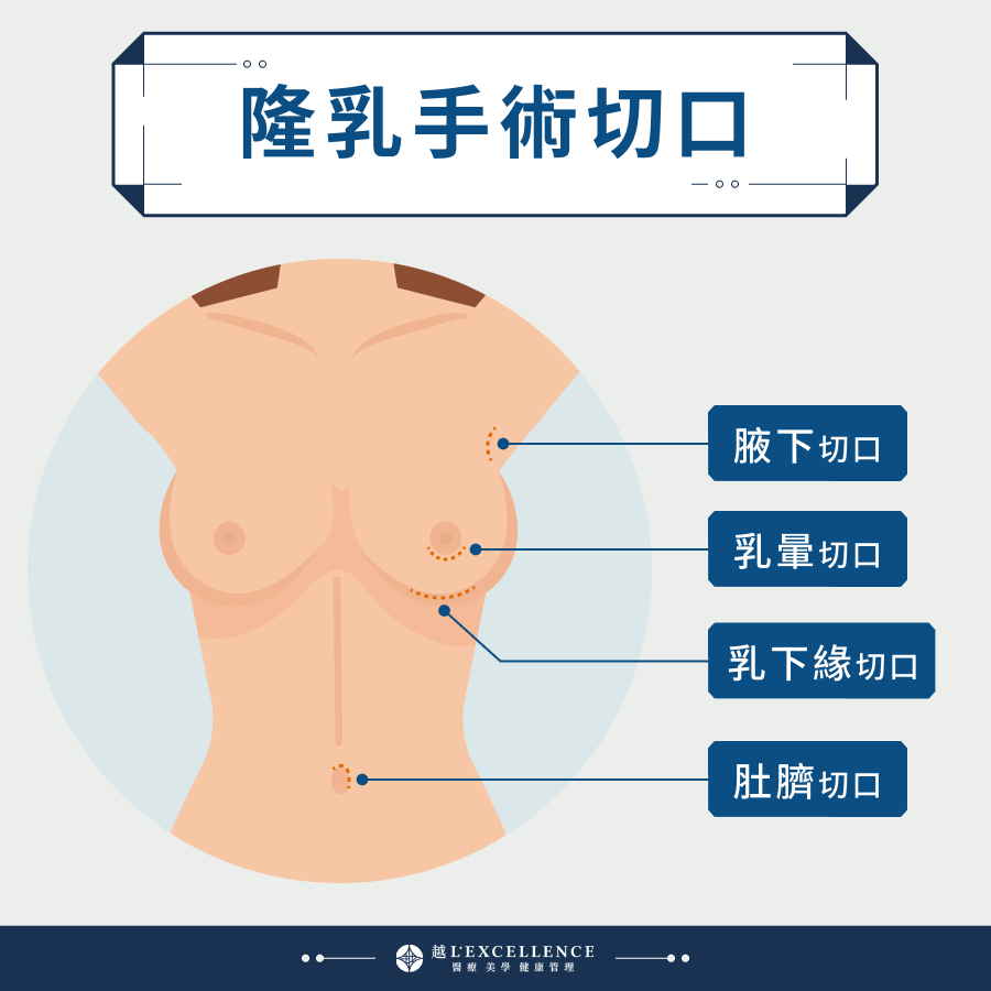 越-15.隆乳-03.png